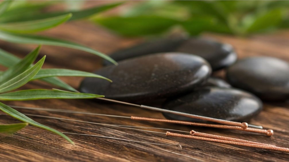 Acupuncture Services